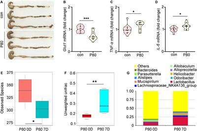 Gut Microbiota Metabolite Fights Against Dietary Polysorbate 80-Aggravated Radiation Enteritis